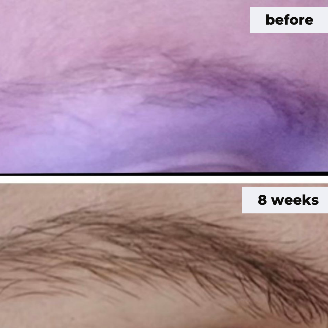 Eyebrow Serum