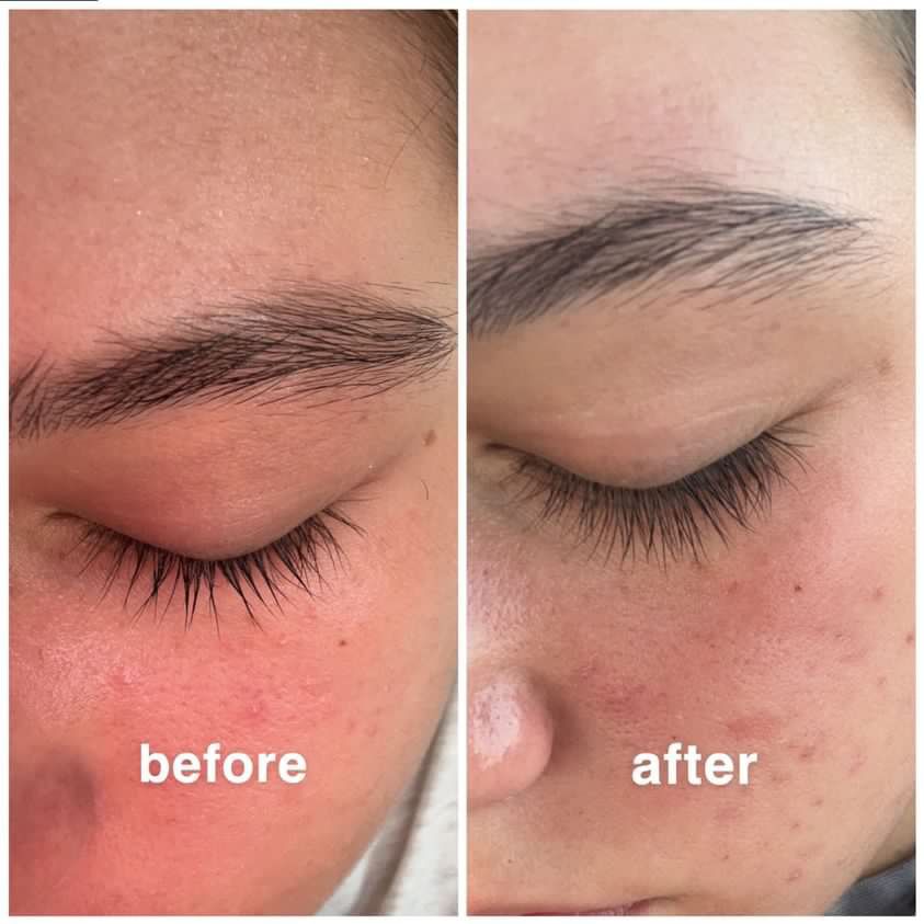 Eyelash Serum 8ml - H