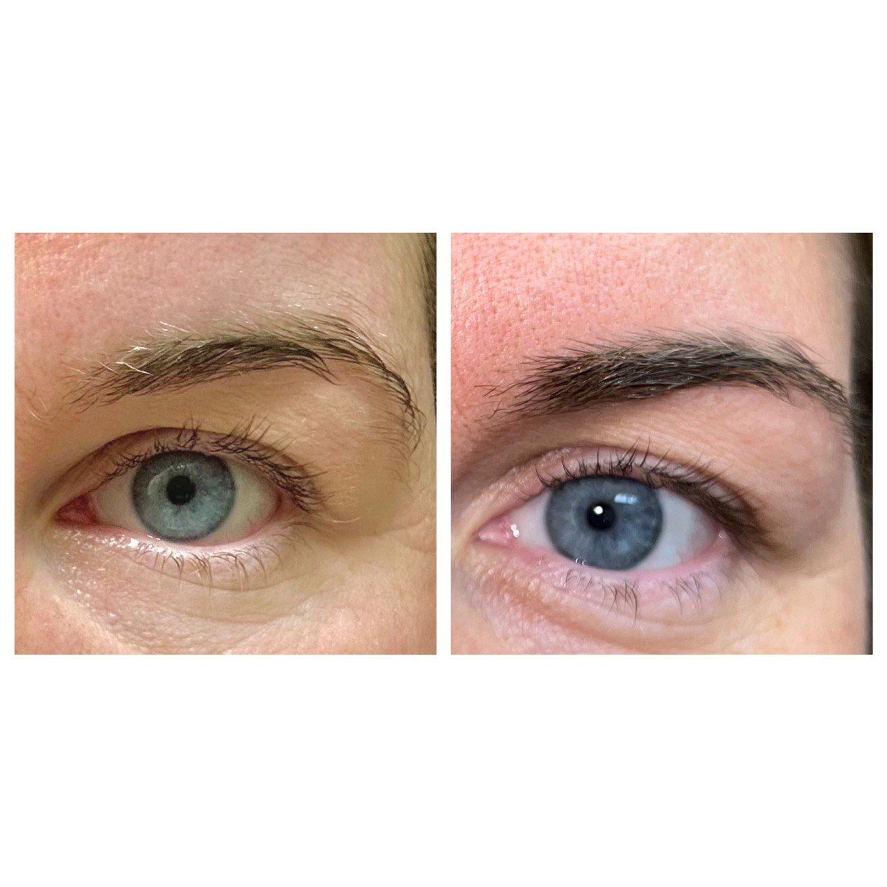 Eyebrow Serum