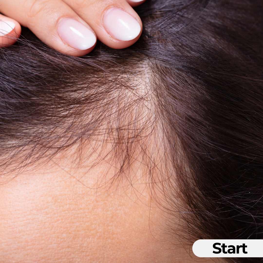 Scalp Serum