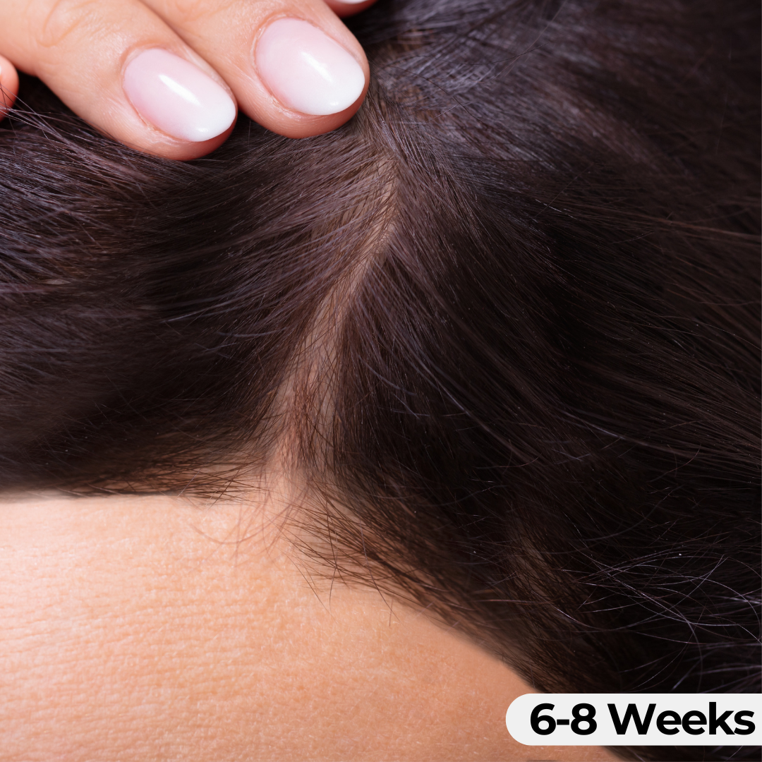Scalp Serum