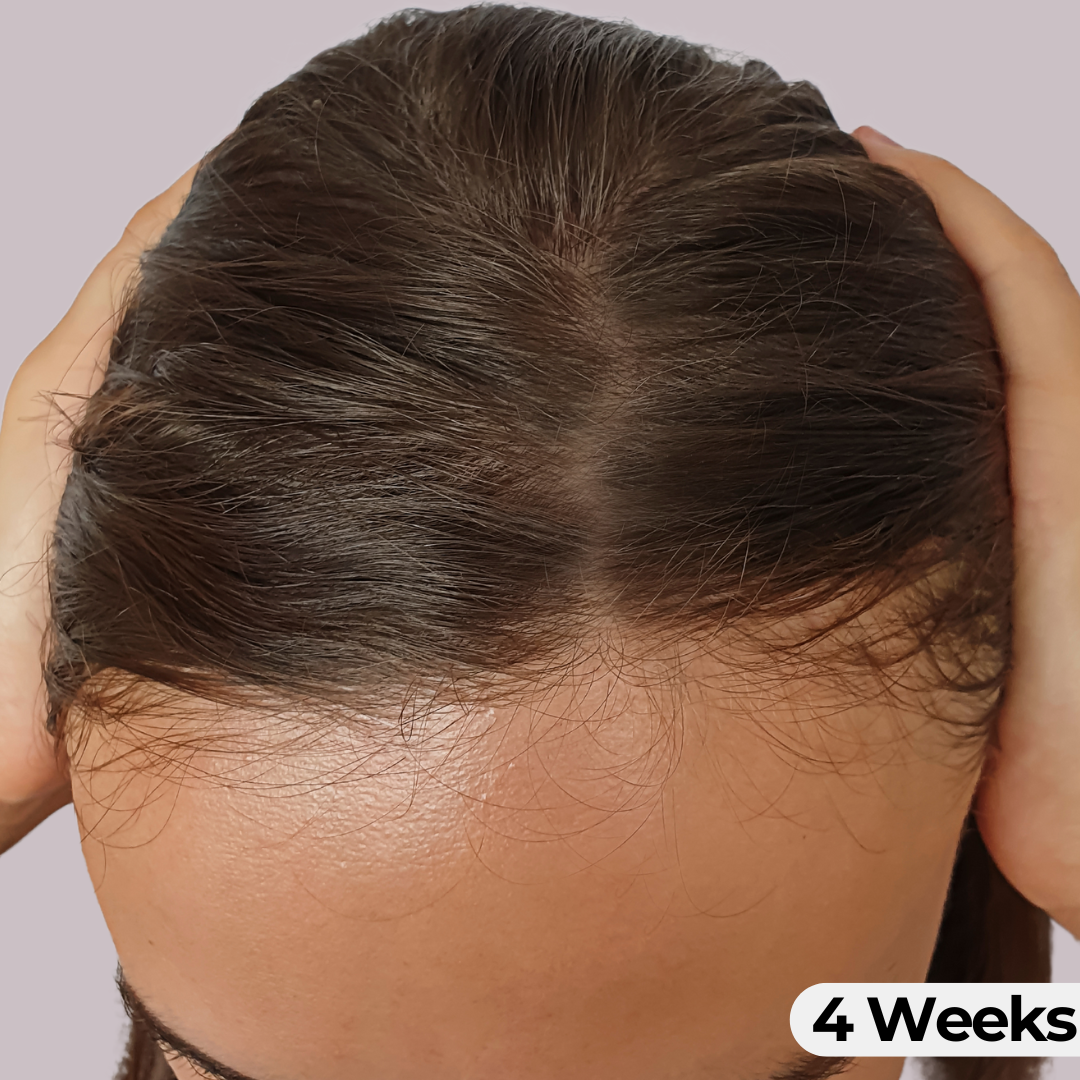 Scalp Serum