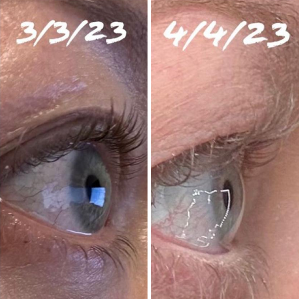 Eyelash Serum 8ml