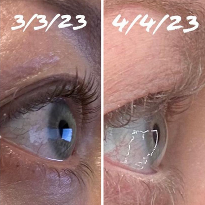 Eyelash Serum 8ml