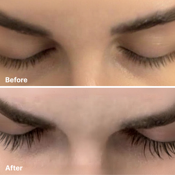 Eyelash Serum 8ml