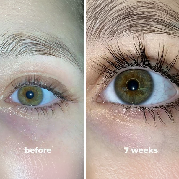 Eyelash Serum 8ml