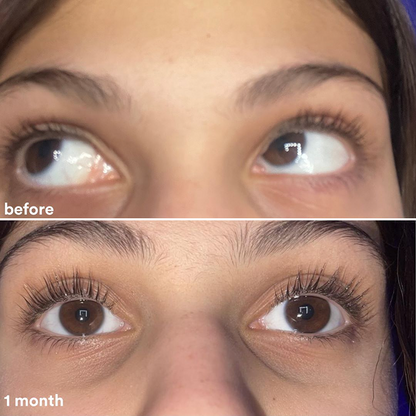 Eyelash Serum 8ml