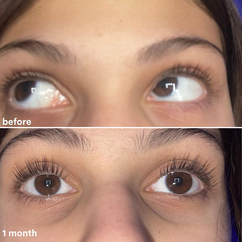 Eyelash Serum 8ml
