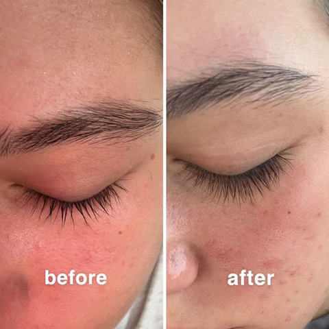 Eyelash Serum 8ml
