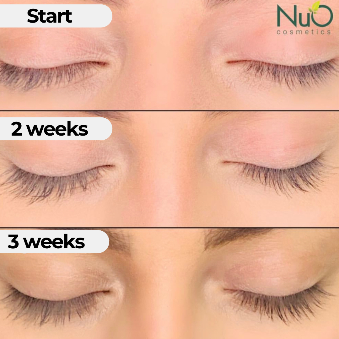 Nanolash eyelash serum-results  Eyelash serum, Eyelashes, Perfect